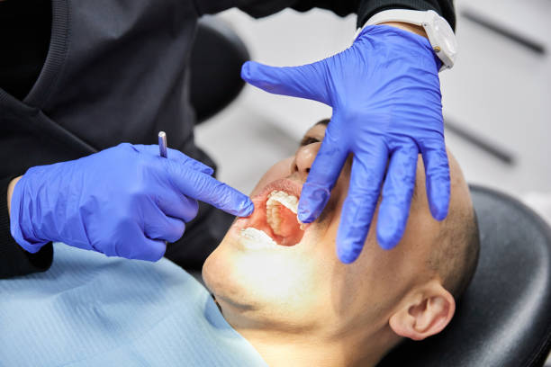 Best Emergency Tooth Extraction in Fox River Grove, IL