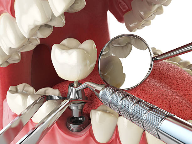 Best Walk-In Emergency Dentist in Fox River Grove, IL